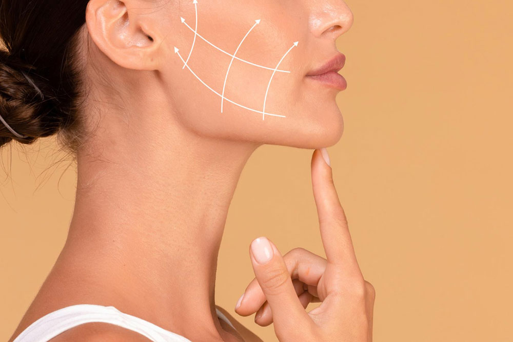 APTOS Thread lifting - Non-Surgical Face Lifting
